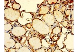 Immunohistochemistry of paraffin-embedded human thyroid tissue using ABIN7151974 at dilution of 1:100 (EDEM2 antibody  (AA 22-300))