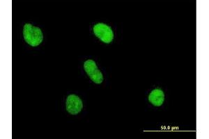 Immunofluorescence of purified MaxPab antibody to UBE2S on HeLa cell. (UBE2S antibody  (AA 1-222))
