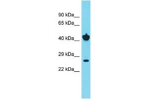 Host: Rabbit  Target Name: Clta  Sample Tissue: Rat Kidney lysates  Antibody Dilution: 1. (CLTA antibody  (C-Term))
