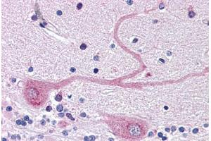 Human Brain, Cerebellum (formalin-fixed, paraffin-embedded) stained with ARMET antibody ABIN343894 at 5 ug/ml followed by biotinylated goat anti-rabbit IgG secondary antibody ABIN481713, alkaline phosphatase-streptavidin and chromogen. (MANF antibody  (C-Term))