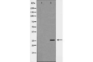 Western blot analysis of extracts of mouse liver, using C1QB antibody.