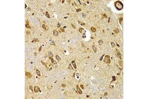 Immunohistochemistry of paraffin-embedded mouse brain using SMAD9 antibody (ABIN5975592) at dilution of 1/100 (40x lens). (SMAD9 antibody)