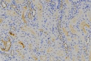 ABIN6275435 at 1/100 staining Human lymph node tissue by IHC-P. (RAB3GAP1 antibody  (Internal Region))