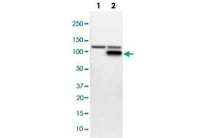 Western blot analysis of Lane 1: NIH-3T3 cell lysate (Mouse embryonic fibroblast cells); Lane 2: NBT-II cell lysate (Rat Wistar bladder tumour cells) with PFKM polyclonal antibody  at 1:100-1:250 dilution.