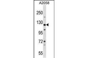 Western blot analysis in A2058 cell line lysates (35ug/lane). (BAT3 antibody  (C-Term))