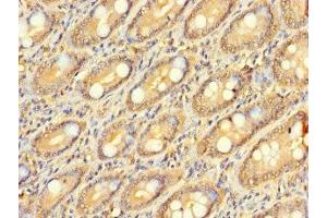 Immunohistochemistry of paraffin-embedded human small intestine tissue using ABIN7176385 at dilution of 1:100 (ZNF562 antibody  (AA 201-426))