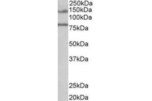 AP31721PU-N EPB41L5 antibody staining of Human Brain (Hippocampus) lysate at 1 µg/ml (35 µg protein in RIPA buffer). (EPB41L5 antibody  (Internal Region))