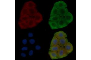 ABIN6262527 and ABIN6278482 staining Hela cells(30 min of UV treatment) by IF/ICC. (IL32 antibody  (Internal Region))