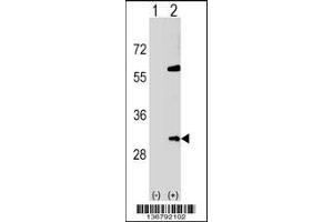 Western blot analysis of SNF8 using rabbit polyclonal SNF8 Antibody using 293 cell lysates (2 ug/lane) either nontransfected (Lane 1) or transiently transfected (Lane 2) with the SNF8 gene. (SNF8 antibody  (N-Term))