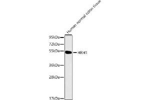 Western blot analysis of extracts of Human normal colon tissue, using HRH1 antibody (ABIN1680348, ABIN3015480, ABIN3015481 and ABIN7101436). (HRH1 antibody)