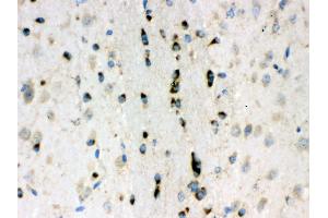Anti- Lumican Picoband antibody, IHC(P) IHC(P): Mouse Brain Tissue (LUM antibody  (AA 68-338))