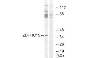 Western blot analysis of extracts from Jurkat cells, using ZDHHC15 antibody. (ZDHHC15 antibody  (C-Term))