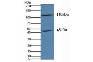 Detection of KIF18A in Human Hela Cells using Polyclonal Antibody to Kinesin Family, Member 18A (KIF18A) (KIF18A antibody  (AA 1-453))