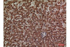 Immunohistochemistry (IHC) analysis of paraffin-embedded Human Liver, antibody was diluted at 1:100. (Adrenomedullin antibody  (Internal Region))