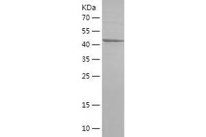 Western Blotting (WB) image for YME1-Like 1 (YME1L1) (AA 502-720) protein (His-IF2DI Tag) (ABIN7284113) (YME1L1 Protein (AA 502-720) (His-IF2DI Tag))