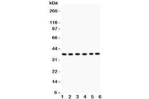 Western blot testing of Rad51 antibody and Lane 1:  22RV1;  2: SW620;  3: PANC;  4: U87;  5: CEM;  6: MM231. (RAD51 antibody  (AA 1-258))