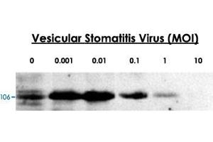 24-hour post infection immunoblots of whole cell lysates from primary murine microglia cells (2x10 6 ) untreated (0) or exposed to vesicular stomatitis virus at a range of viral particle/cell ratios. (DDX58 antibody  (C-Term))