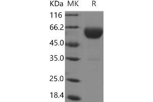 Western Blotting (WB) image for Carboxypeptidase B2 (Plasma) (CPB2) protein (His tag) (ABIN7321061)