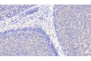 Detection of IL6R in Human Lymph node Tissue using Polyclonal Antibody to Interleukin 6 Receptor (IL6R) (IL-6 Receptor antibody  (AA 216-356))