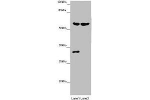 Western blot All lanes: TERF2 antibody at 14 μg/mL Lane 1: Mouse thymus tissue Lane 2: MCF-7 whole cell lysate Secondary Goat polyclonal to rabbit IgG at 1/10000 dilution Predicted band size: 60, 33 kDa Observed band size: 60, 31 kDa (TRF2 antibody  (AA 78-238))
