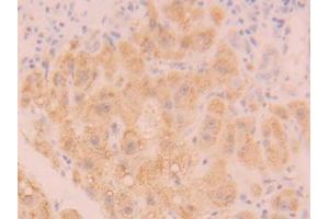 DAB staining on IHC-P; Samples: Human Liver Tissue (Catalase antibody  (AA 401-523))