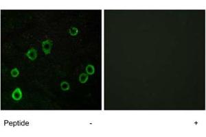 Immunofluorescence analysis of LoVo cells, using ADORA2A polyclonal antibody .