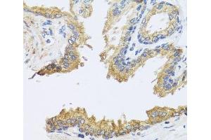 Immunohistochemistry of paraffin-embedded Human prostate using ARL6 Polyclonal Antibody at dilution of 1:100 (40x lens). (ARL6 antibody)