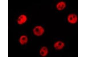 ABIN6278568 staining LOVO by IF/ICC. (ELF5 antibody  (Internal Region))