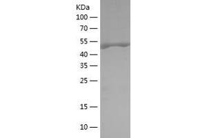 PDPK1 Protein (AA 351-556) (His-IF2DI Tag)