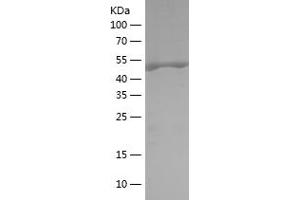 Western Blotting (WB) image for 3-phosphoinositide Dependent Protein Kinase-1 (PDPK1) (AA 351-556) protein (His-IF2DI Tag) (ABIN7121615) (PDPK1 Protein (AA 351-556) (His-IF2DI Tag))