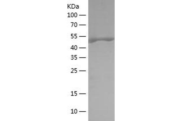 PDPK1 Protein (AA 351-556) (His-IF2DI Tag)