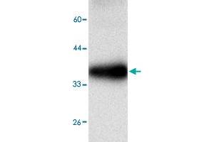 Western blot analysis in PRDX3 recombinant protein with PRDX3 monoclonal antibody, clone 9a560  at 1 : 1000 dilution. (Peroxiredoxin 3 antibody)