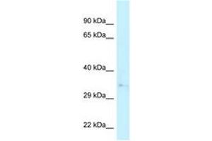 Image no. 1 for anti-Capping Protein (Actin Filament) Muscle Z-Line, alpha 2 (CAPZA2) (N-Term) antibody (ABIN6747888) (CAPZA2 antibody  (N-Term))