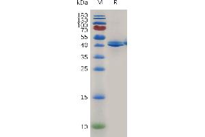 SDS-PAGE (SDS) image for Tumor Necrosis Factor Receptor Superfamily, Member 13B (TNFRSF13B) (AA 1-125) protein (Fc Tag) (ABIN7491129)