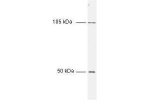 All incubations except color development were performed using TBS supplemented with 0. (Nuclear Factor kappa B p50 (NFkB p50) (N-Term) antibody)