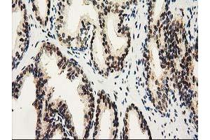 Image no. 5 for anti-Nonhomologous End-Joining Factor 1 (NHEJ1) antibody (ABIN1499729) (NHEJ1 antibody)