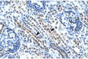 Immunohistochemical staining (Formalin-fixed paraffin-embedded sections) of human kidney with ANKRD11 polyclonal antibody  at 4-8 ug/mL working concentration. (ANKRD11 antibody  (N-Term))