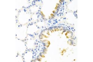 Immunohistochemistry (IHC) image for anti-Kallikrein 11 (KLK11) (AA 1-250) antibody (ABIN6142946)
