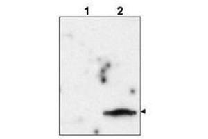 Image no. 1 for anti-Feline Immunodeficiency Virus Matrix (MA) (FIV p15) (Internal Region) antibody (ABIN299654) (Feline Immunodeficiency Virus Matrix (MA) (FIV p15) (Internal Region) antibody)