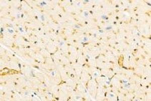Immunohistochemistry analysis of paraffin-embedded mouse heart using,DMPK (ABIN7073790) at dilution of 1: 2000 (DMPK antibody)