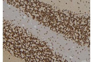 Immunohistochemistry (IHC) image for anti-Interferon Regulatory Factor 3 (IRF3) (pSer386) antibody (ABIN6255286)