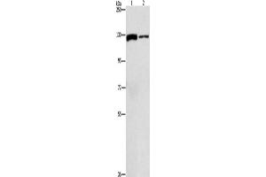 Western Blotting (WB) image for anti-ATP Citrate Lyase (ACLY) antibody (ABIN2429587) (ACLY antibody)