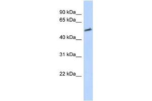 Transfected 293T; WB Suggested Anti-IKZF2 Antibody Titration: 0. (IKZF2 antibody)