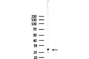 Western blot analysis of lysates from EC304 cells, using TM2 Antibody at 1/1000 dilution.