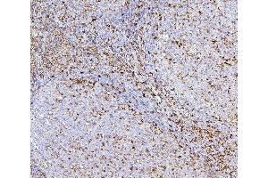 IHC analysis of CD43 using anti-CD43 antibody (ABIN7601042). (CD43 antibody  (AA 272-400))