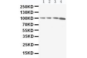 Anti-RIAM antibody, Western blotting Lane 1: Rat Thymus Tissue Lysate Lane 2: Rat Spleen Tissue Lysate Lane 3: Rat RAJI Tissue Lysate Lane 4: HL-60 Cell Lysate (Amyloid beta (A4) Precursor Protein-Binding, Family B, Member 1 Interacting Protein (APBB1IP) (AA 647-666), (C-Term) antibody)