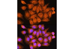 Immunofluorescence analysis of HeLa cells using CF Rabbit pAb (ABIN7266431) at dilution of 1:100. (CCDC11 antibody  (AA 1-300))