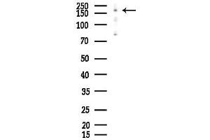 anti-PHD and Ring Finger Domains 1 (PHRF1) antibody