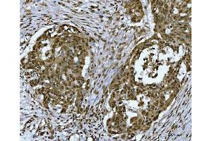 IHC analysis of SNRPN using anti-SNRPN antibody (ABIN3043934).