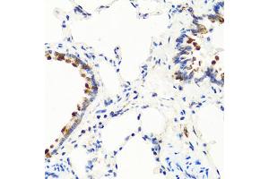 Immunohistochemistry of paraffin-embedded rat lung using NTF3 antibody (ABIN6290616) at dilution of 1:100 (40x lens).